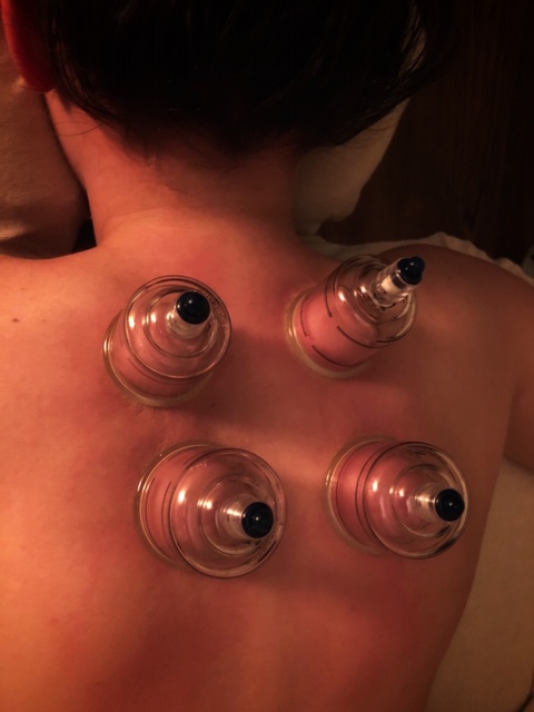 Lubbock Cupping Therapy at Luminous You Massage